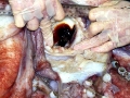Giant Squid