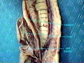 Hagfish
