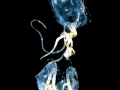 Irukandji Sea Jelly